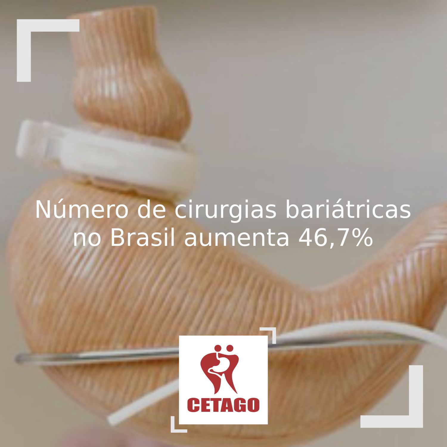 Número de cirurgias bariátricas no Brasil aumenta 46,7%